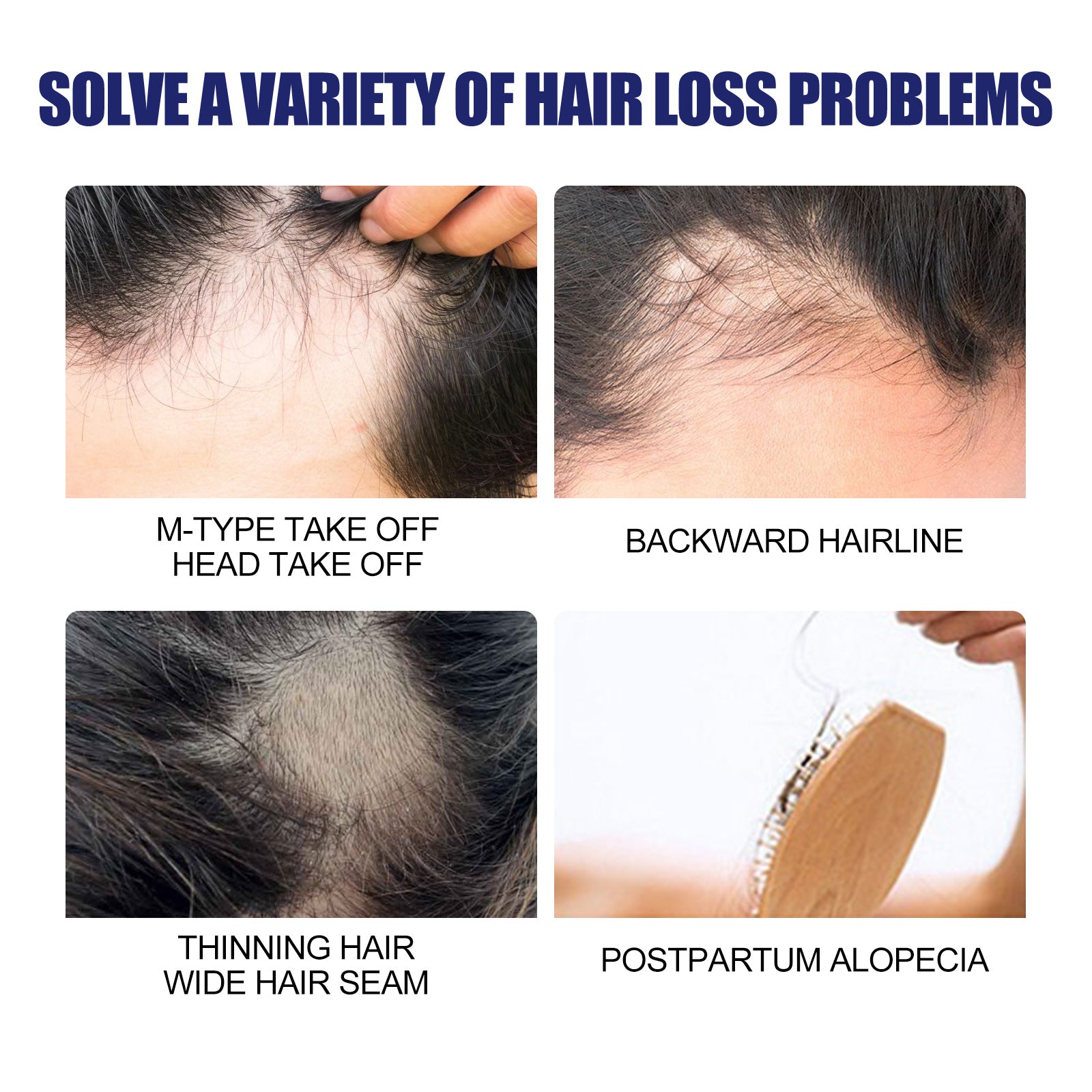 Máquina de espuma para cabelos masculinos, repara a raiz do cabelo, espuma hidratante e espessa para cabelos masculinos.