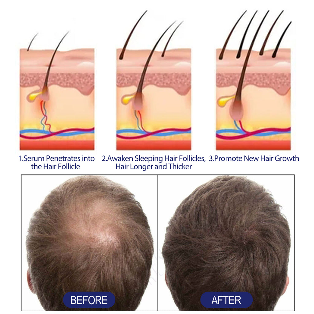 Máquina de espuma para cabelos masculinos, repara a raiz do cabelo, espuma hidratante e espessa para cabelos masculinos.