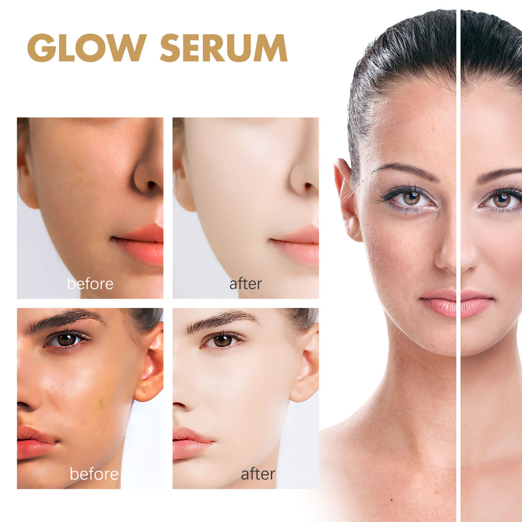 Essência fotossensível EELHOE com própolis e nicotinamida, reduz marcas de acne, hidrata, ilumina e clareia a pele do rosto.