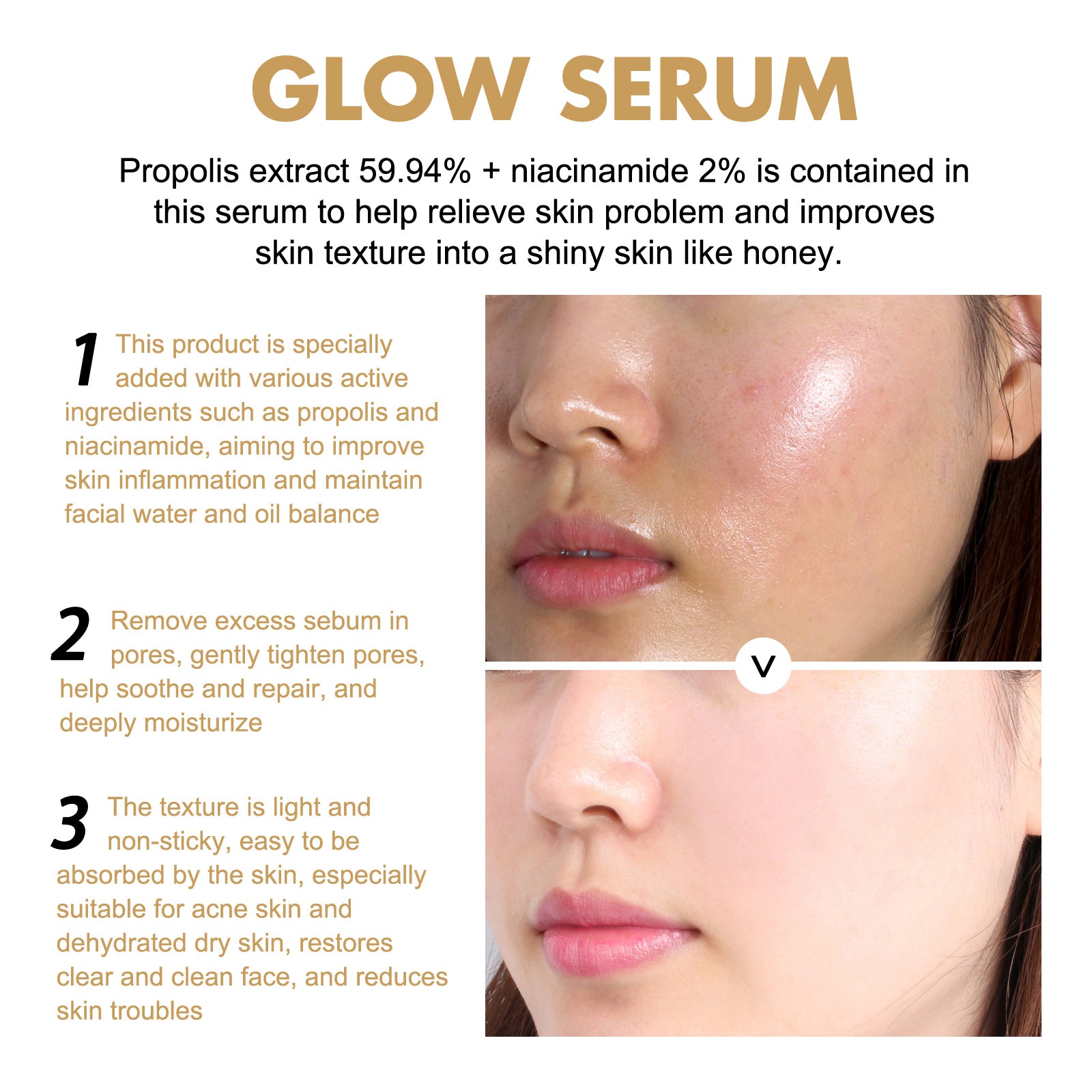Essência fotossensível EELHOE com própolis e nicotinamida, reduz marcas de acne, hidrata, ilumina e clareia a pele do rosto.