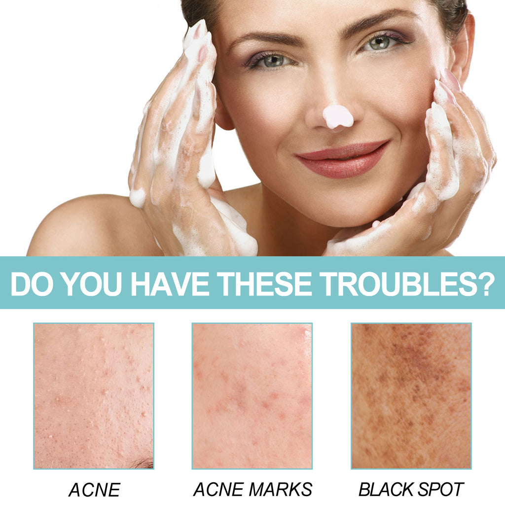 Sabonete de Limpeza Reparador de Proteínas EELHOE: Limpa os poros, clareia manchas escuras causadas por acne, hidrata e ilumina a pele do rosto.