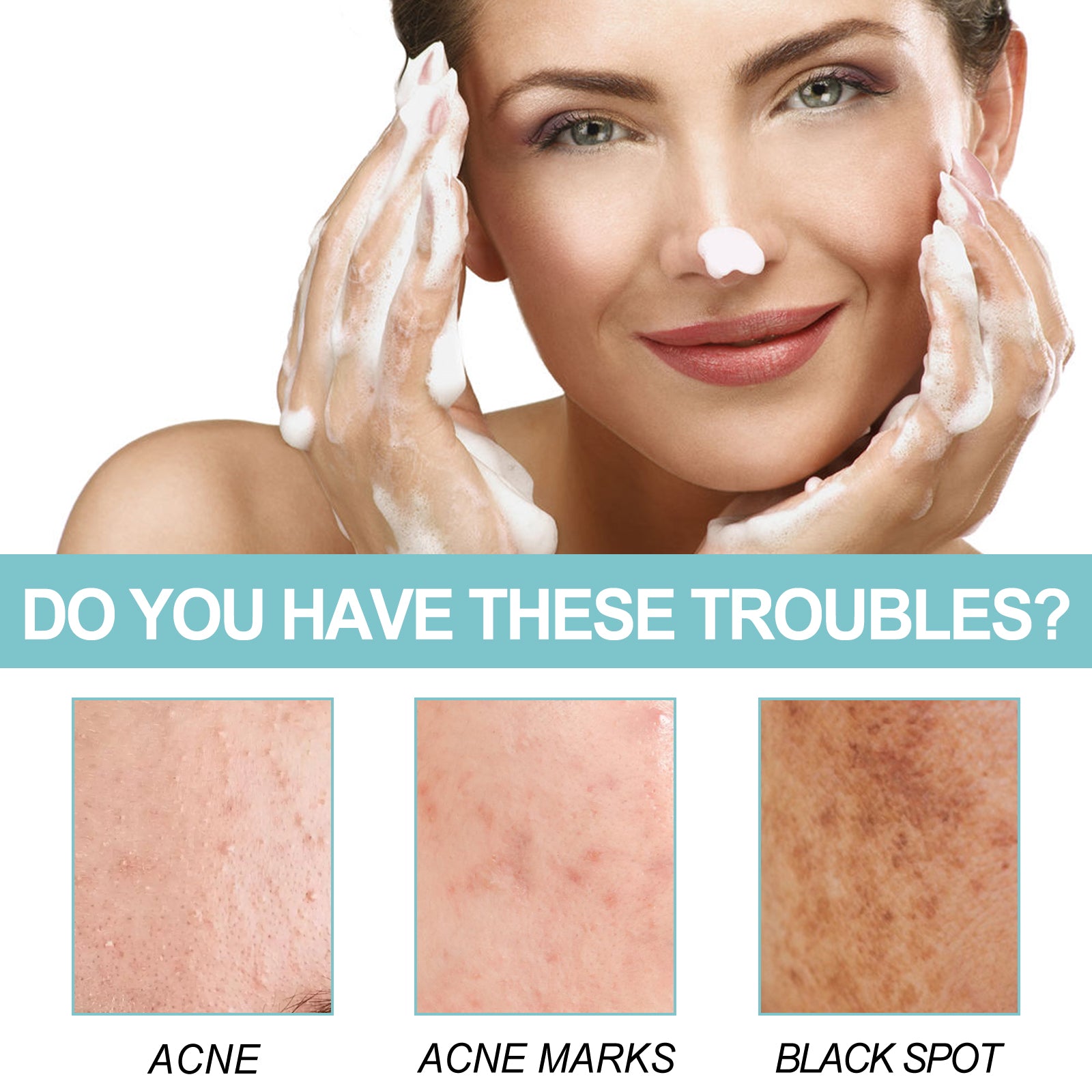 Sabonete de Limpeza Reparador de Proteínas EELHOE: Limpa os poros, clareia manchas escuras causadas por acne, hidrata e ilumina a pele do rosto.
