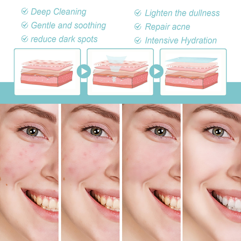 Sabonete de Limpeza Reparador de Proteínas EELHOE: Limpa os poros, clareia manchas escuras causadas por acne, hidrata e ilumina a pele do rosto.