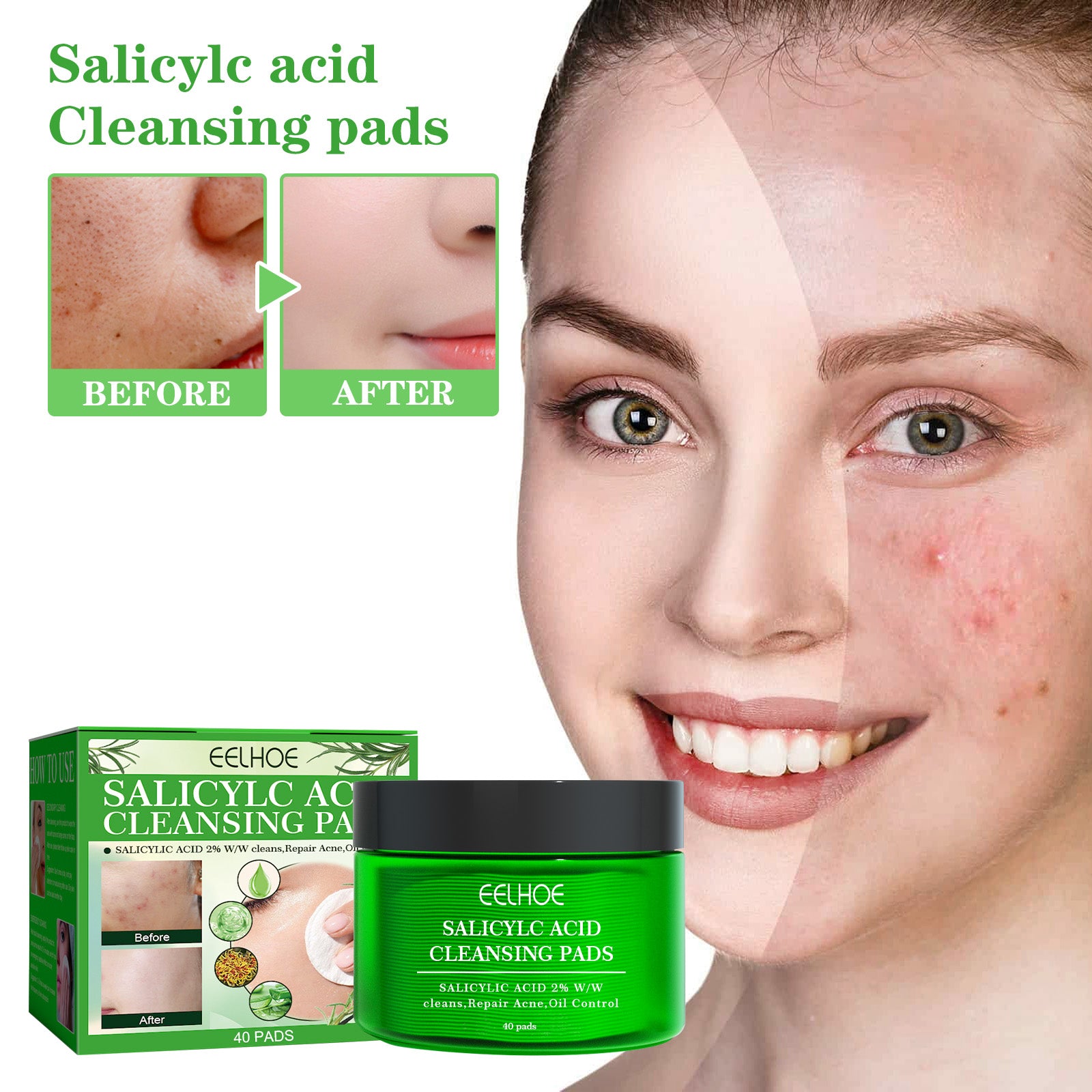 Ácido salicílico para limpeza profunda, controle da oleosidade, remoção de cravos e espinhas, limpeza suave e reparação muscular da acne.
