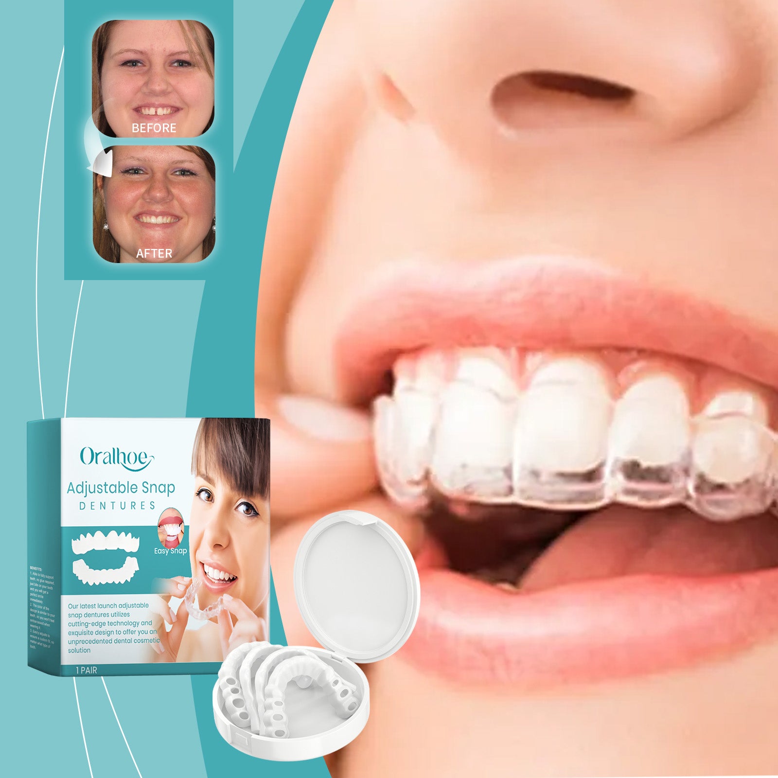 Próteses dentárias ajustáveis com fivela, próteses confortáveis e ajustáveis que se adaptam à força de mastigação e aos dentes.